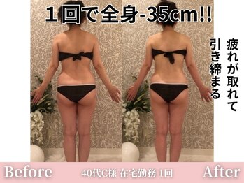 アメリイ 百合ヶ丘 新百合ヶ丘(Amerii)/【痩身】1回で全身-35センチ痩せ