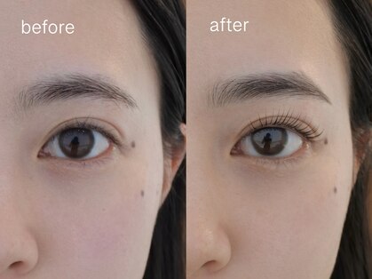 ネストアイ(NEST eye)の写真