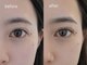 ネストアイ(NEST eye)の写真