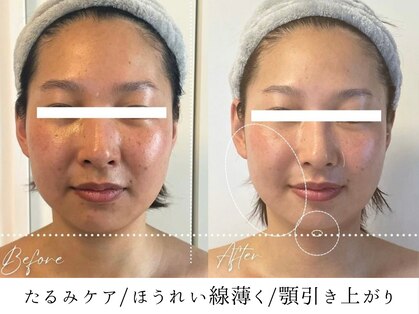 パーム(Perm)の写真