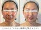 パーム(Perm)の写真