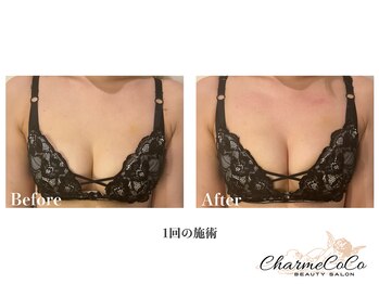 シャルムココ 蔵前店(CharmeCoCo)/お客様Before→After
