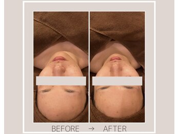 ミルトゥ(myrte)/Before→After