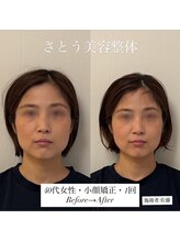 さとう美容整体 町田店/シュッとしたお顔に大変身