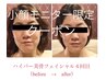 【小顔モニター】モニター限定☆60分5回コース・通常900000円→45000円