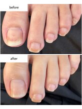 ケアプラス(care plus)/フットネイルケア