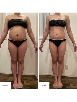 ミエル 恵比寿店(Miel)/セル脂肪ケア/産後ダイエット