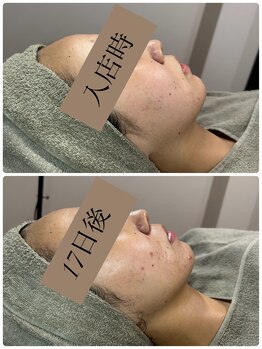 ビーエルティー(blt)/レモンボトル