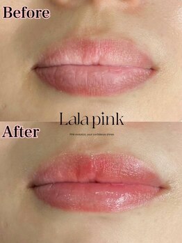 フレイヤビューティー スハダラボ 恵比寿(Freyia Beauty Suhada LABO)/-ララピンク-