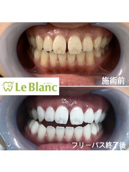 ルブラン 奈良店(Le Blanc)/毎日の笑顔に差がつく！