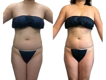 シェリー トウキョウ 西葛西店(Cherie Tokyo)/漢方よもぎ蒸しB/A◎痩身/西葛西