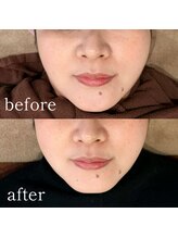 シーズボーテ(C's Beaute)/リバウンドなしのレモンボトル