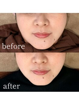 シーズボーテ(C's Beaute)/リバウンドなしのレモンボトル