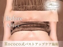 ロココ 水戸店(Rococo)/BEFORE/AFTER