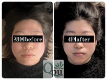 キュープ 富士店(Qpu)の雰囲気（エラ張りの原因は凝りがほとんど！凝りをほぐしてV字の輪郭へ）