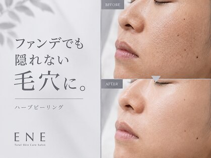 イーネ(ENE)の写真