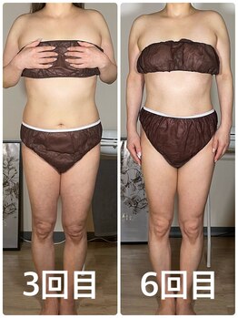 サロン ド サッコ(salon de sacco)/【6回終了後】ビフォーアフター