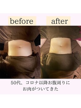 心和(こより)/beforeafter