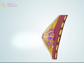 サラエクセレント 梅田(SARA EXCELLENT)/《バストアップ》