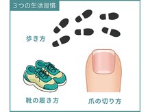 巻き爪研究所 表参道院/巻き爪予防の３つのポイント