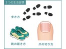 巻き爪予防の3つのポイント