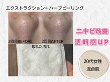 ミラ(Mira...)/☆Before→After☆