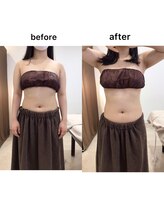 ジョワイユ(Joyeux)/腸の位置でお腹は変わる