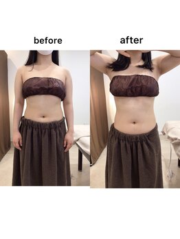 ジョワイユ(Joyeux)/腸の位置でお腹は変わる