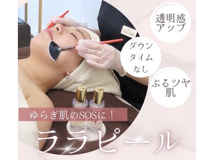ラ ルアナ(La Luana)の写真