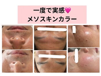 ピュアリ(Purely) /日本初上陸!メソスキンカラー