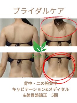 リシャイン(Reshine)/ブライダルBA