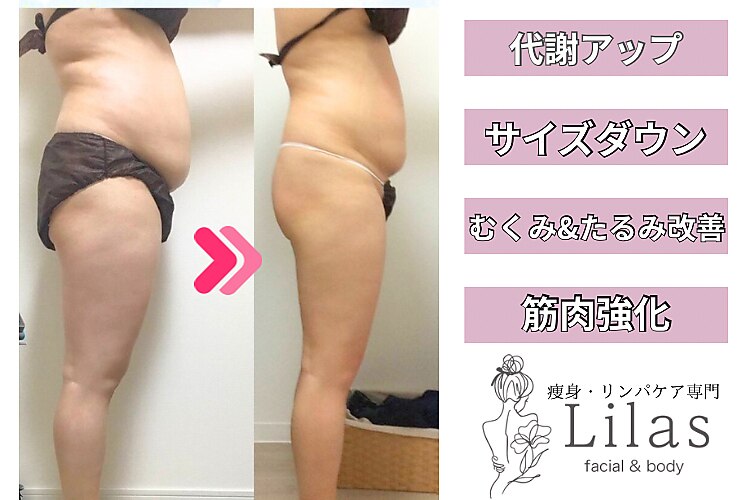 リラ(Lilas)｜ホットペッパービューティー