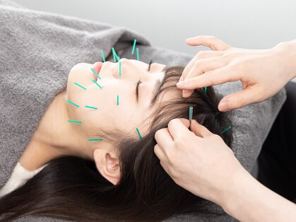 美容鍼灸整体サロンopt.の写真