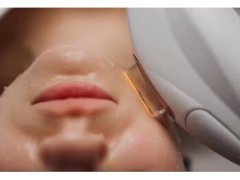 クリアー(clear)の写真/毛穴・くすみ・たるみに透明感あふれる美肌ケア