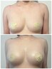 【先着3名様!口コミ・写真掲載可能な方】小胸×ぽっこりお腹卒業腸もみ120分