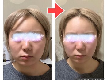 エスボニータ(es bonita)/●小顔コルギ