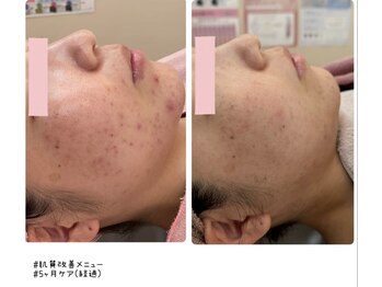 アンドバイ(&.BY)/