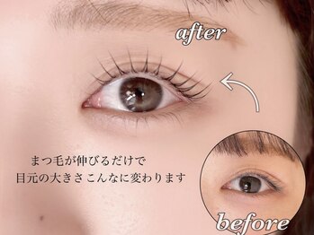 ノエル(Noel)/before→after　担当なぎ