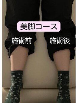 整体院オアシス イオンモール福津店(OASIS)/美脚施術【ビフォーアフター】