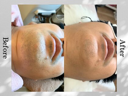 アンフルール(Une fleur)の写真