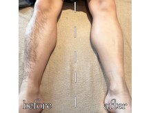 エステティック バイ イム(esthetic by im)の雰囲気(全身脱毛回数券◎)