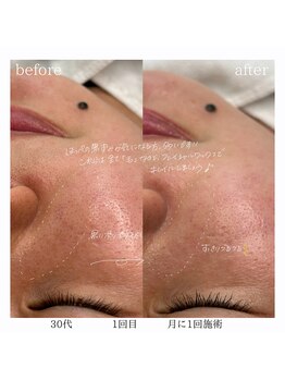 レオン(Leon)/ビフォーアフター