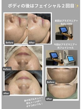 エネイブル(ENable)/