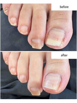 ケアプラス(care plus)/フットネイルケア