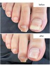 フットネイルケア