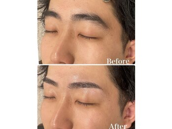 アカヌケ(AKANUKE)/眉毛ワックス脱毛