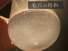 ダリア(Dahlia)/毛穴洗浄後の汚れ