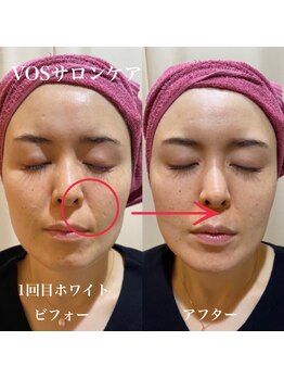 マ シェリ(ma cherie)/新メニューHARI美容導入しました