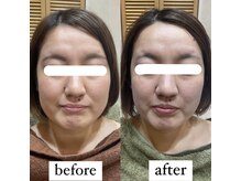 トゥーリ 春日店(tuuli)/ビフォーアフター