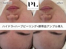 プルスキンサロン 大阪店(pull skin salon)/